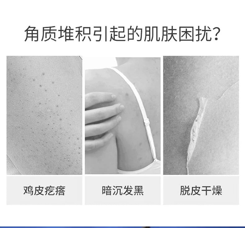 50g Vitamin E Urea Cream Skin Care Cream Moisturizing and Moisturizing Skin Care Skin Face Cream Autumn