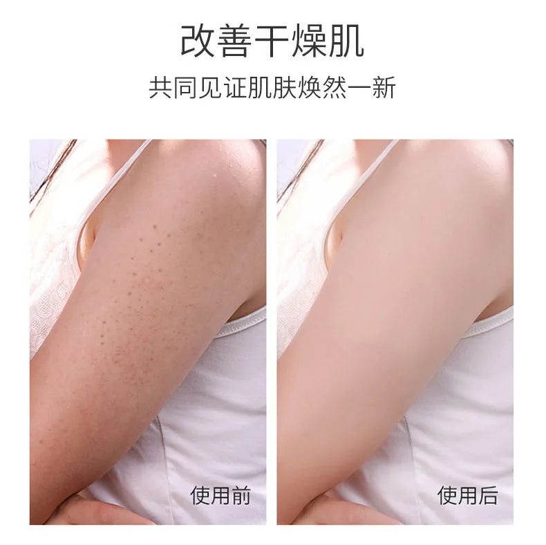 50g Vitamin E Urea Cream Skin Care Cream Moisturizing and Moisturizing Skin Care Skin Face Cream Autumn